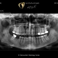 بختیار یوسفی مکری